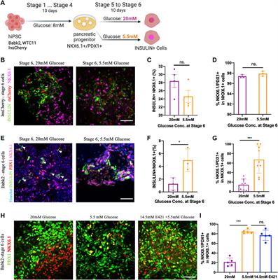 Glucose Concentration in Regulating Induced Pluripotent Stem Cells Differentiation Toward Insulin-Producing Cells
